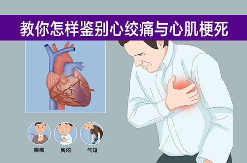 教你如何区分心绞痛和心肌梗死