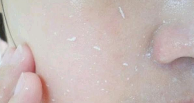 脸搓泥是怎么回事