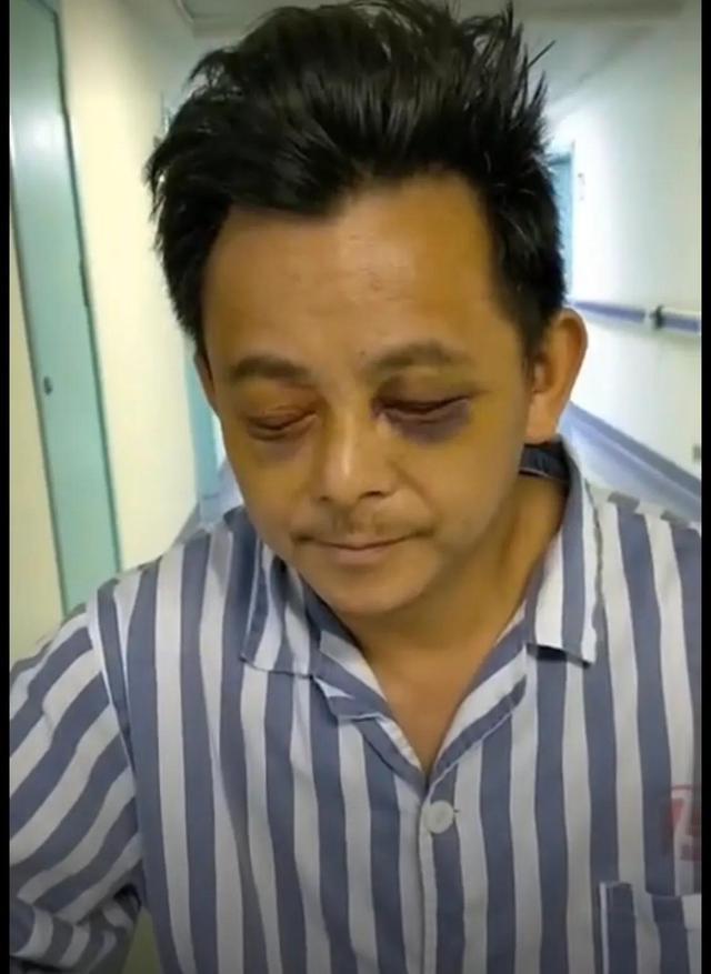 紧急寻人!姜堰男子半夜从医院走失,因外伤有明显熊猫眼