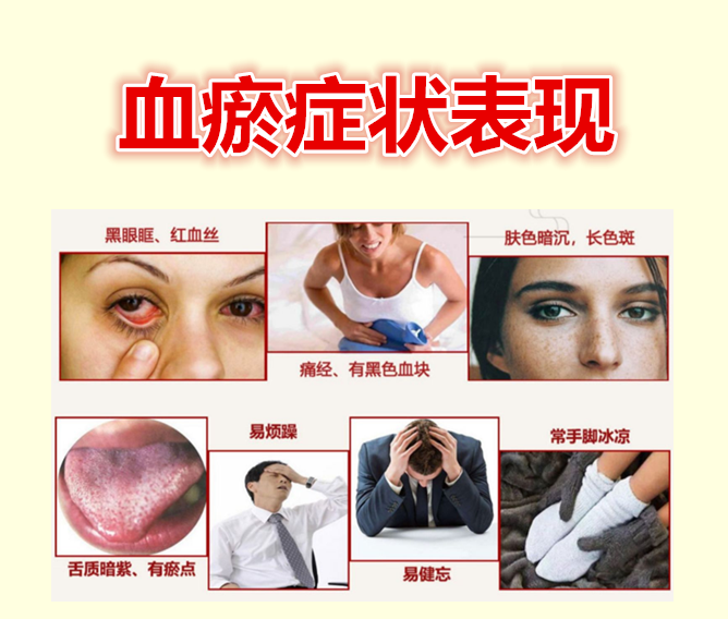 心脑血管疾病,多因血瘀!两味中药泡水,每天一杯,活血化瘀防病