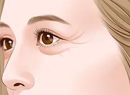 弹弹弹,弹不走的鱼尾纹怎么办?眼霜,胶原蛋白