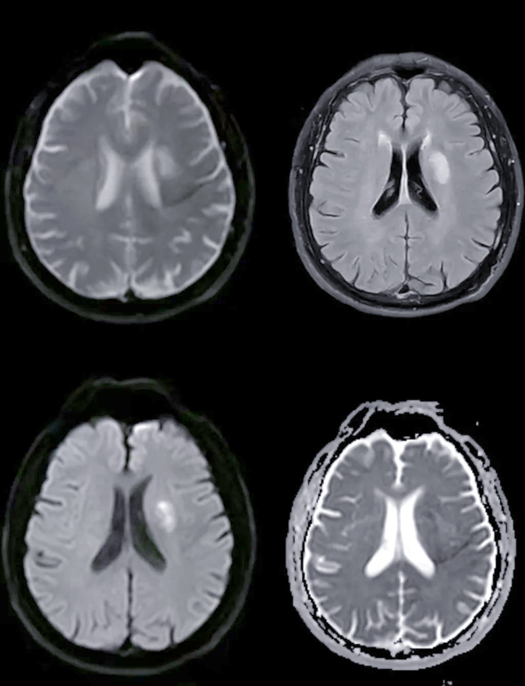 我院引进先进磁共振成像系统