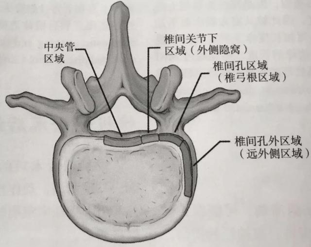 腰椎间盘在不同分区的突出