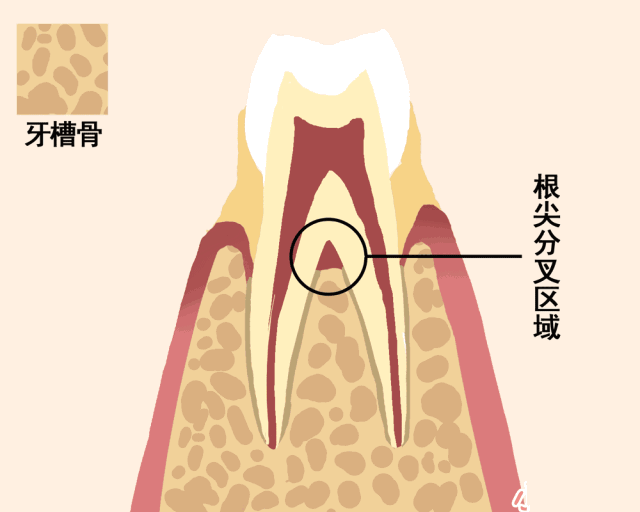 为什么同样是洁牙?过程就不同?