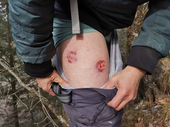 野生大熊猫为何会咬人?