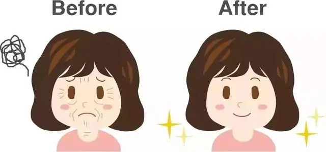 哪种面部提升方法维持时间久?李方奇谈小切口提升维持时间如何