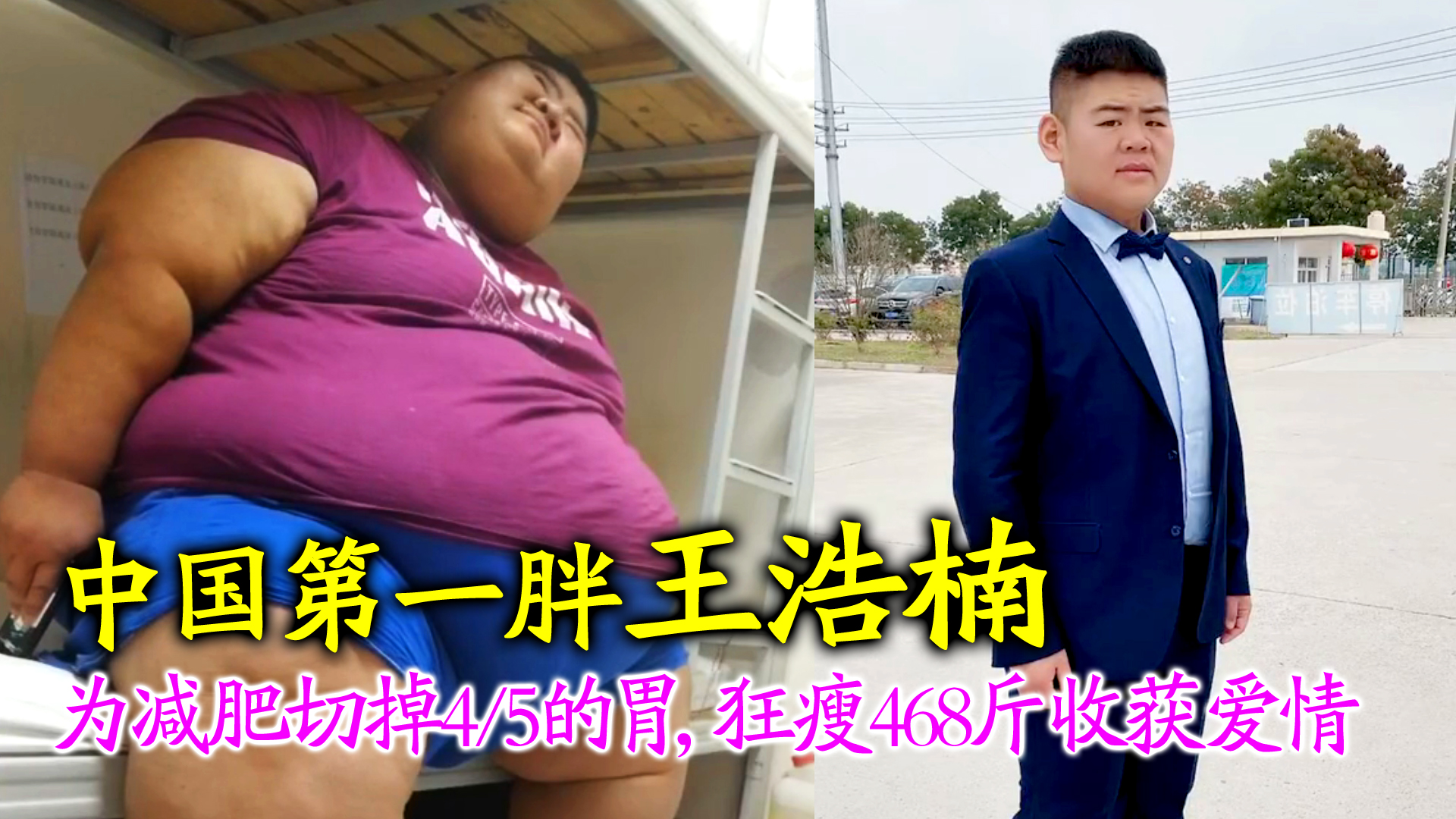 中国第一胖王浩楠:为减肥切掉4/5的胃,一年狂瘦468斤收获爱情!