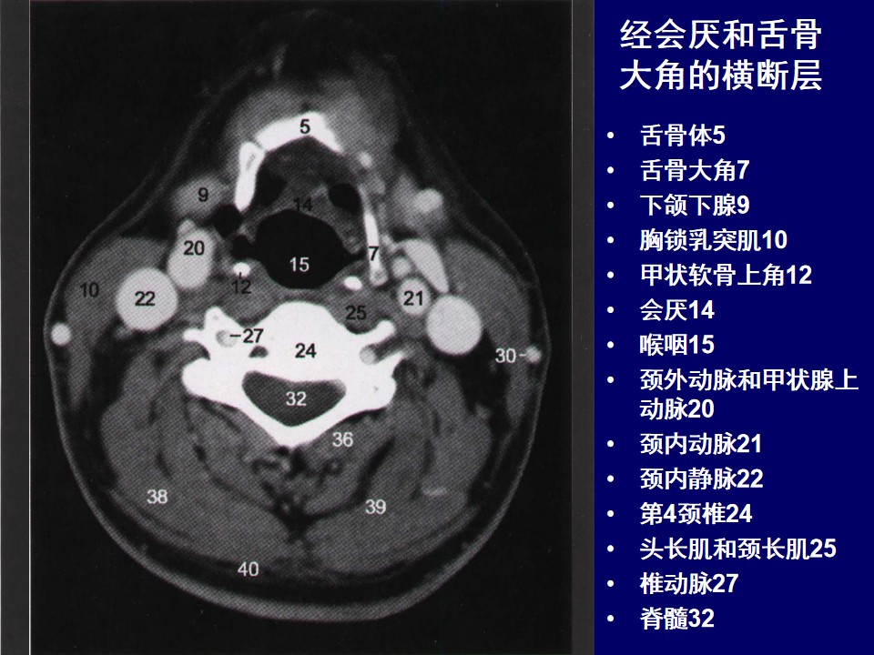 喉部MRI断层解剖图片