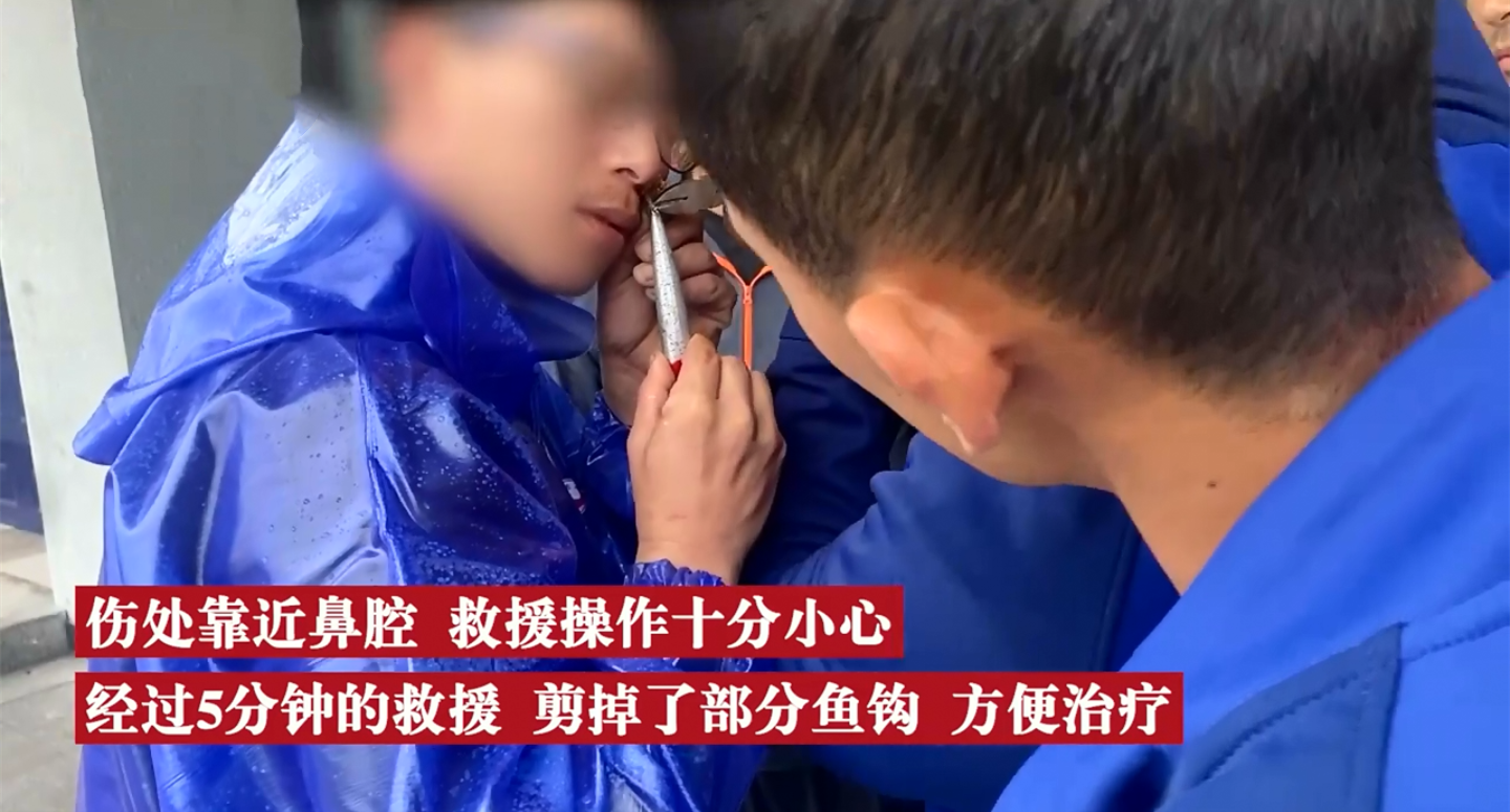 浙江:男子钓鱼结果被鱼"钓"了,鱼钩刺穿鼻孔,只怪倒刺太利
