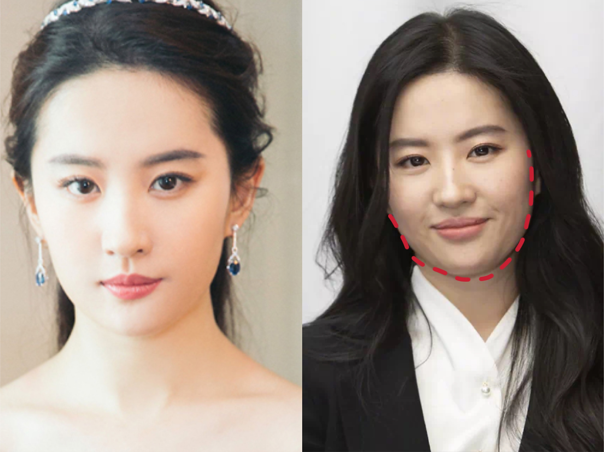 明星都逃不过的"发腮",我们应该如何预防?