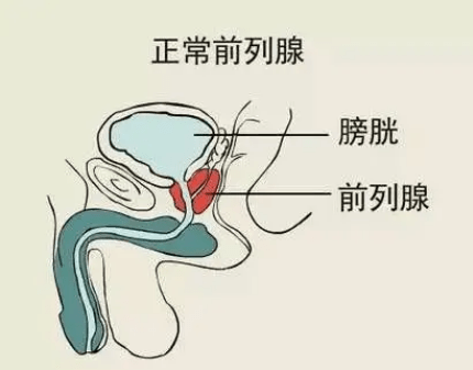 前列腺发炎有什么症状呢