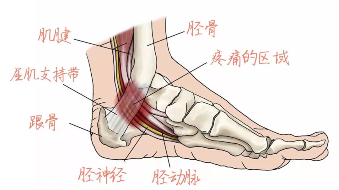 脚踝内侧解剖图图片