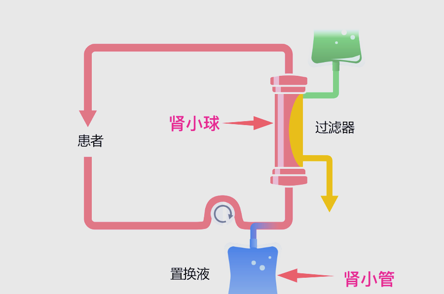 血液透析,血液滤过与血液灌流:全面了解肾脏替代治疗的原理与作用