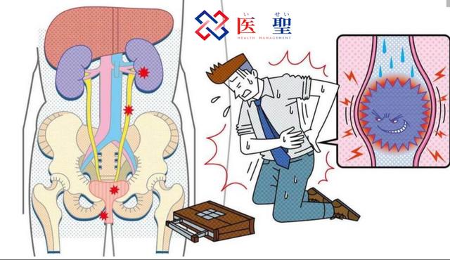 突如其来,人生最大级的疼痛!尿路结石恢复后复发率也很高