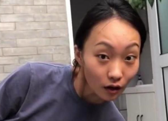 网红"疯产姐妹"邵雨轩,小时候照片曝光,网友:发际线逆生长了