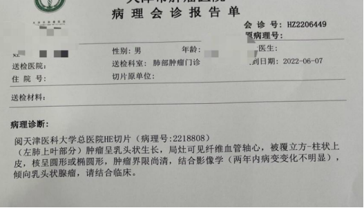 肺磨玻璃结节精准诊断很重要,从浸润性腺癌到良性肿瘤