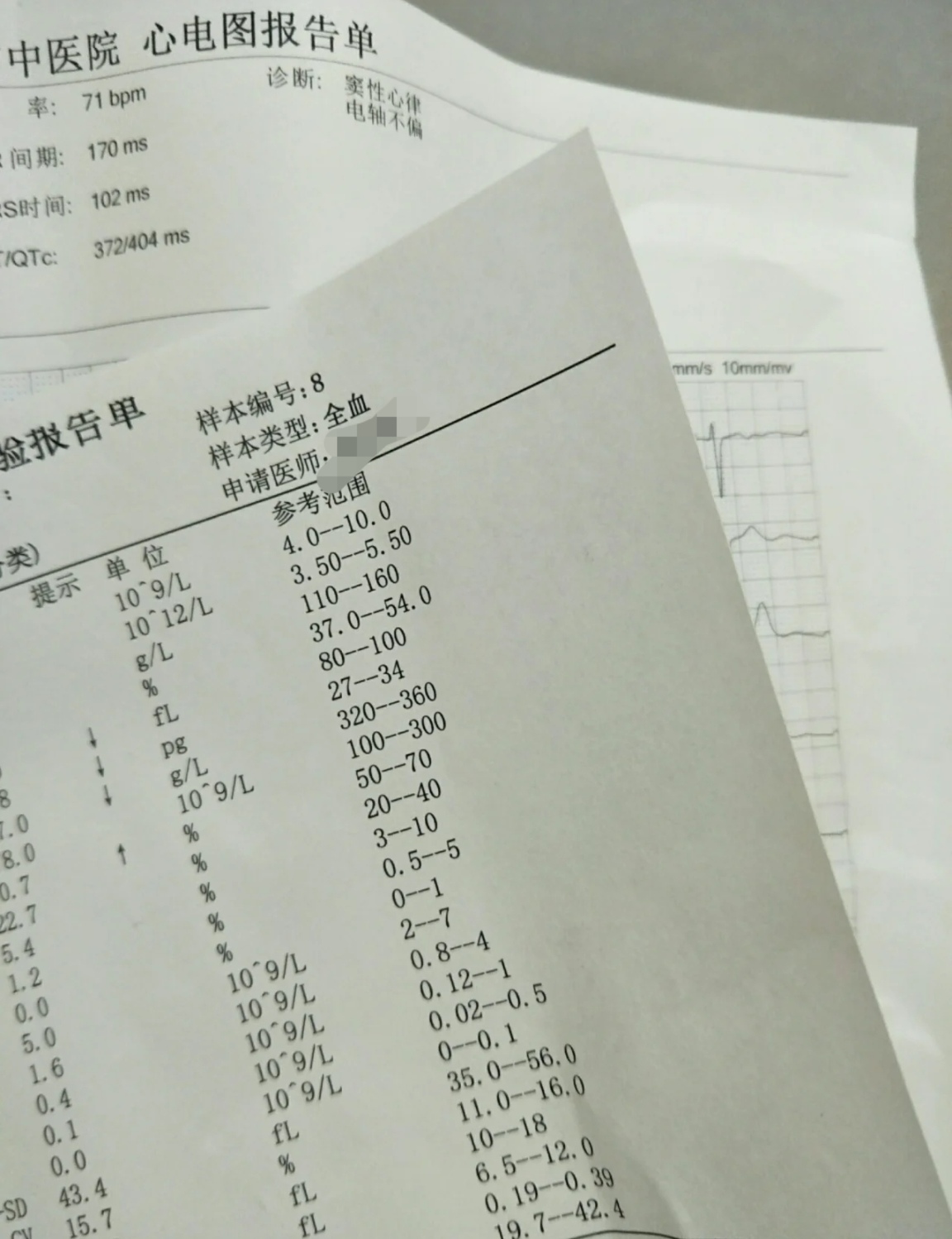 舌头感觉像被烫了一样怎么回事