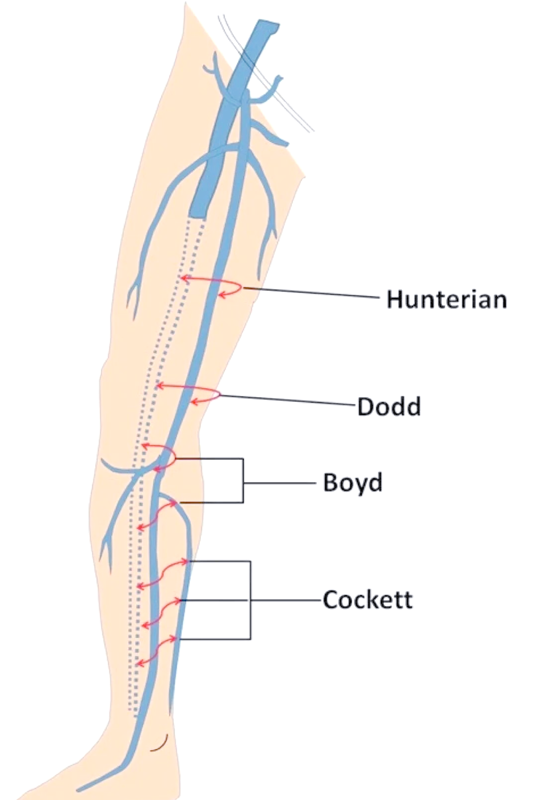 胫旁穿支静脉在下肢静脉系统中的作用与临床意义