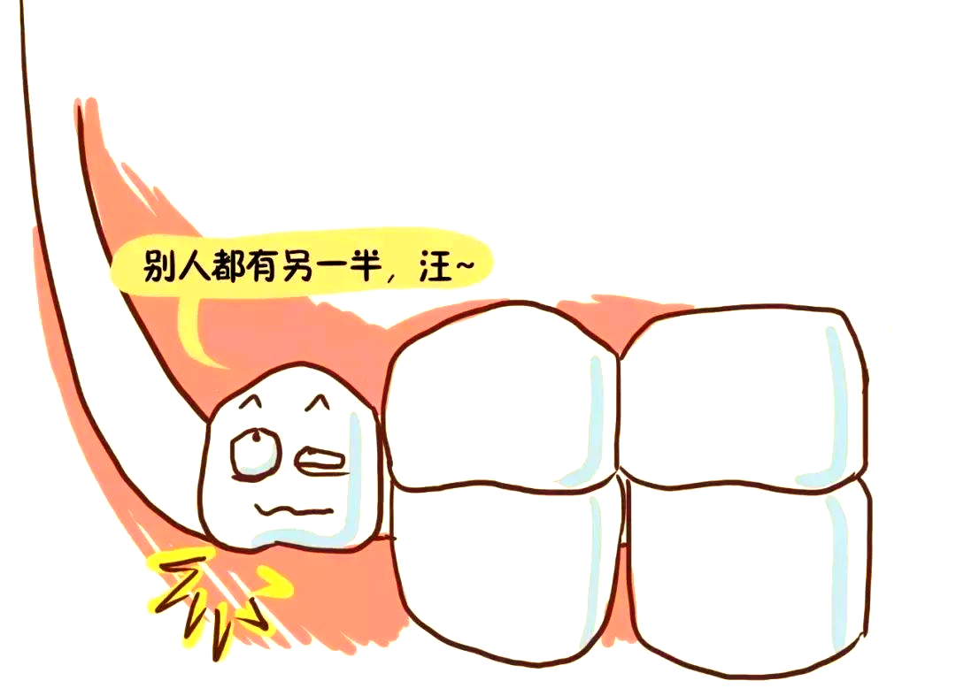 科普揭秘:智齿的多样性与拔除选择