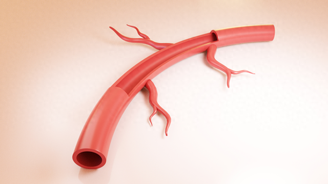 sci科研制图|如何用3dmax做血管模型