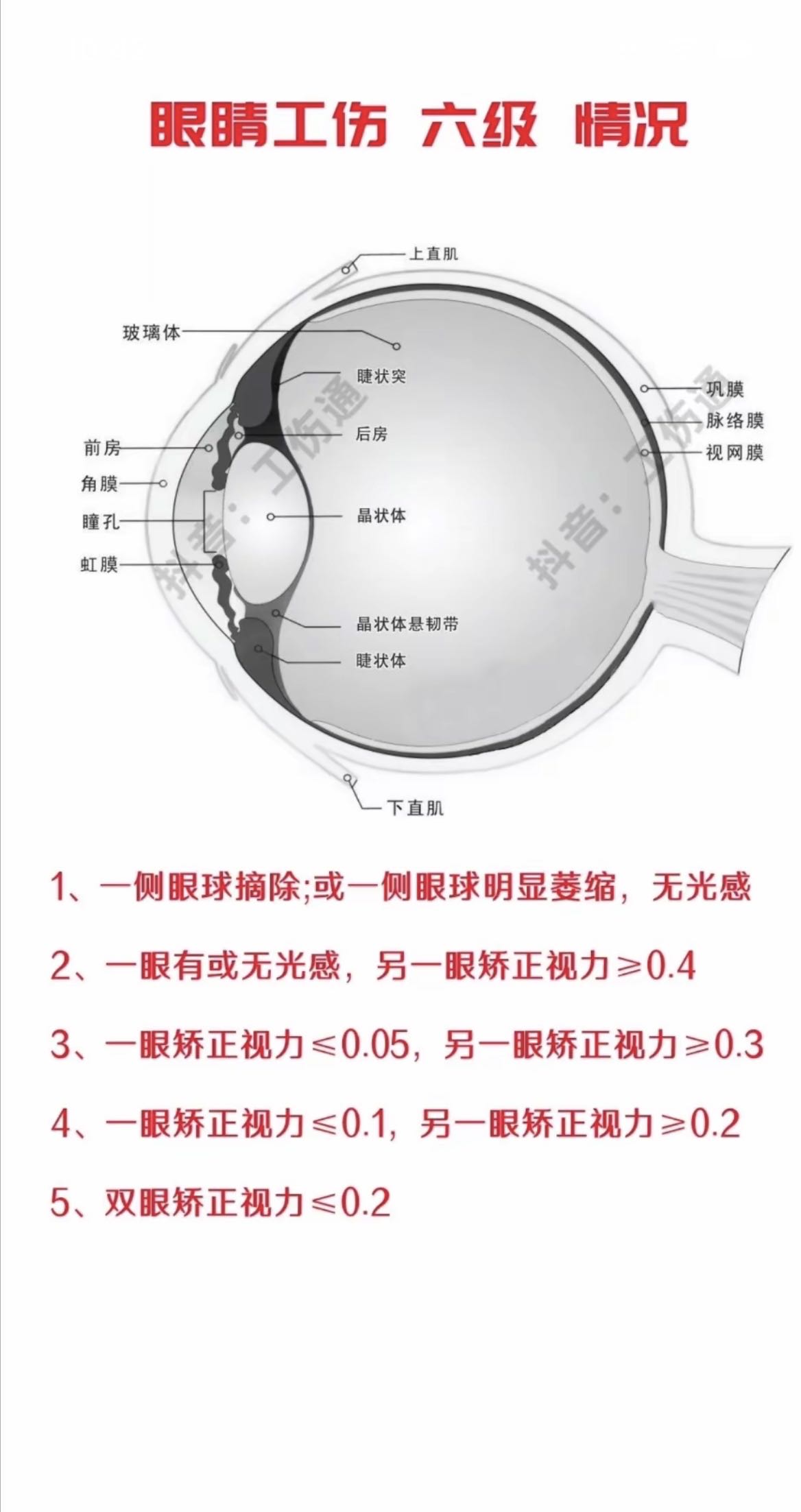 眼睛工伤等级参考图