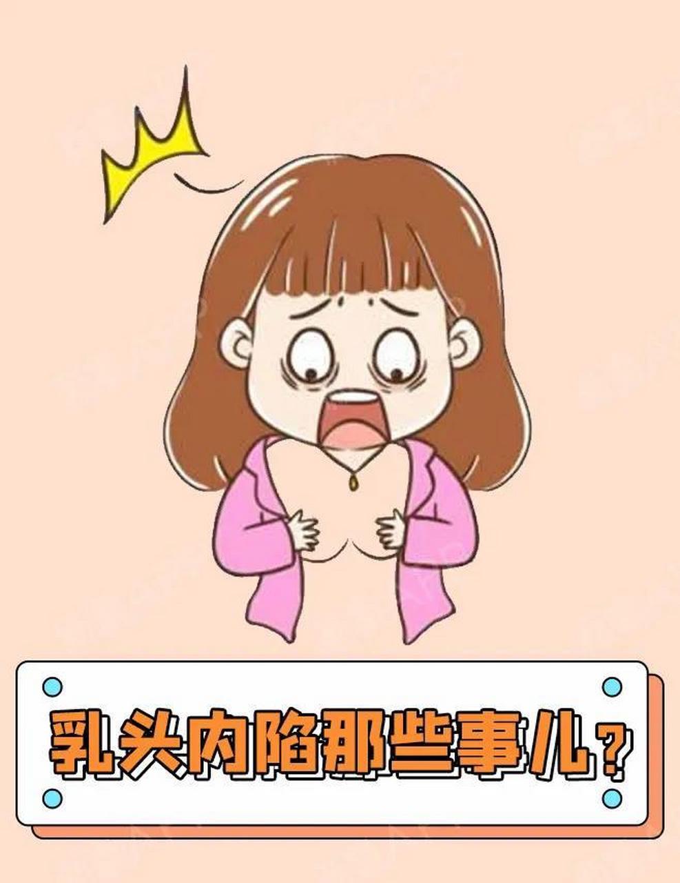 女性乳头内陷是一种常见的乳房问题,患者的乳头向内缩进,出现隆起或