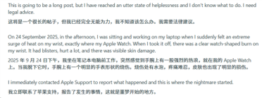 苹果Apple Watch灼伤手腕！更痛的是心寒：维权半年处处碰壁