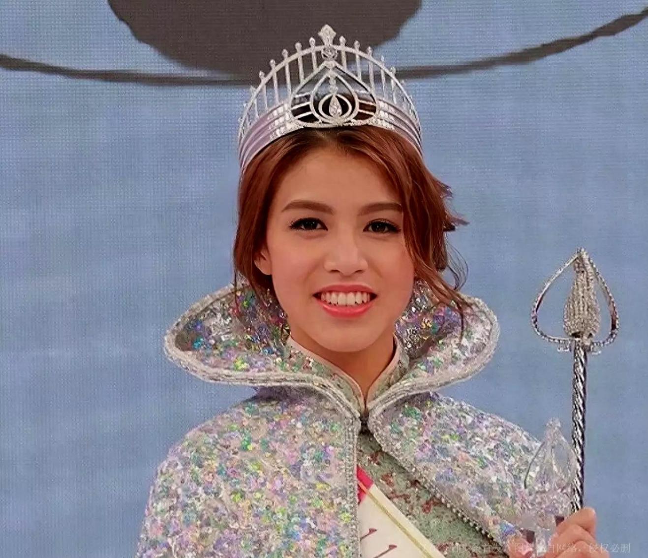 tvb知名港姐冠军晒泳装美照整牙后颜值飙升,与男友甜蜜恩爱