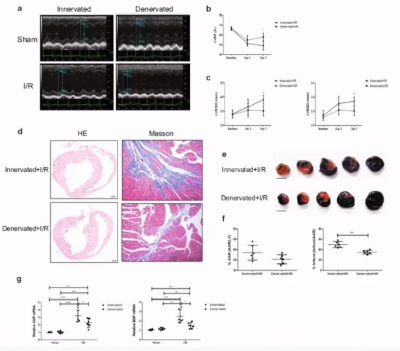 徐标教授:炎症调控与心肌缺血再灌注损伤