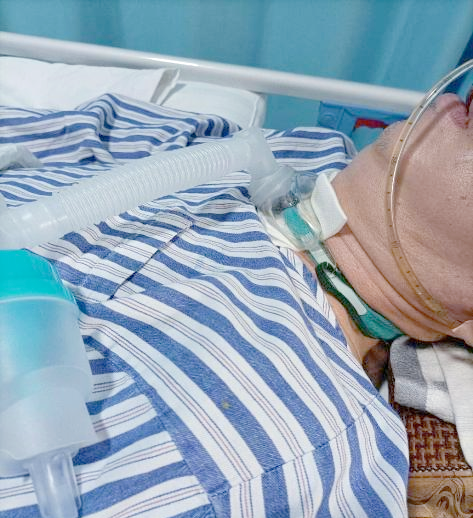 如何护理气管切开的病人?掌握这些技巧就够了!