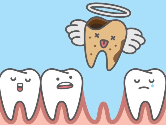 缺牙危害大!具体有哪方面的影响?