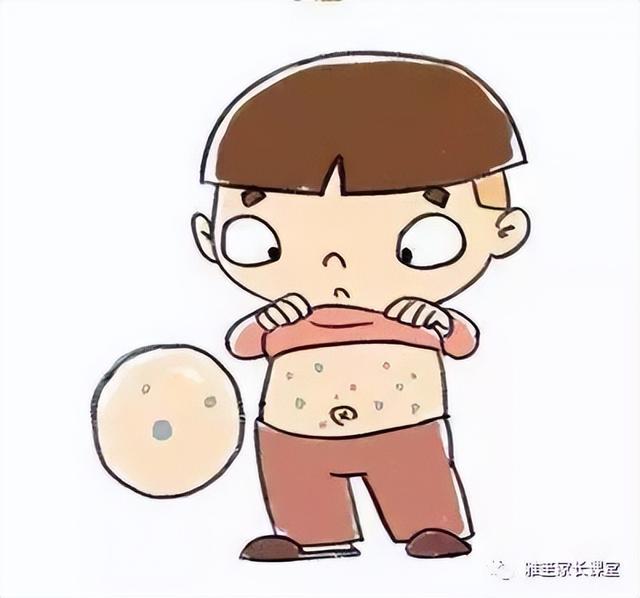 预防水痘的卡通图片图片