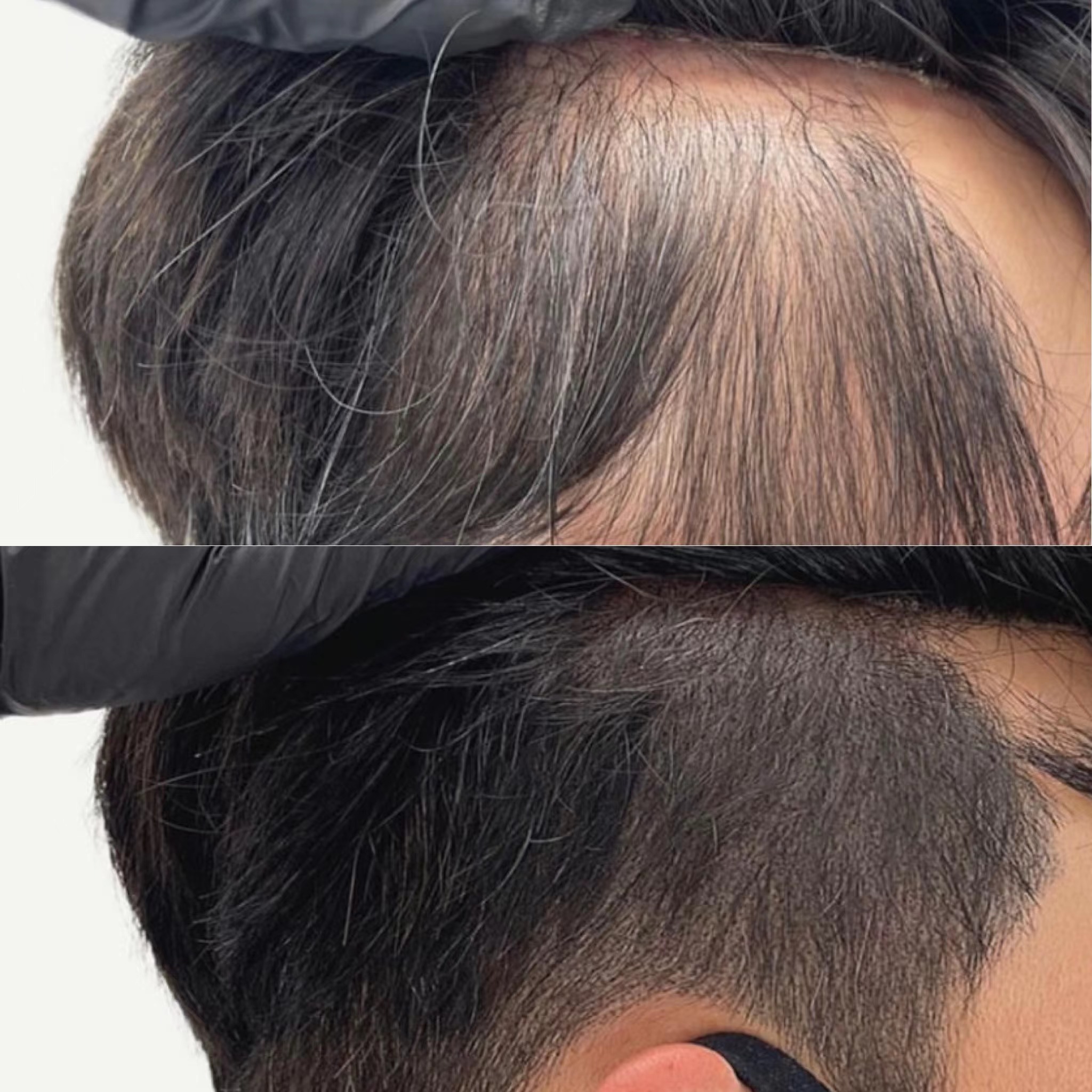 纹发真实效果如何?纹发到底能维持几年?