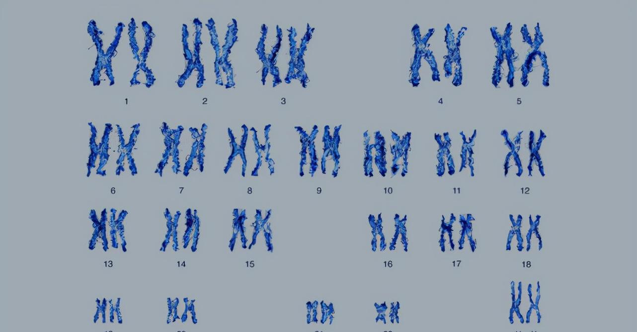 男性染色体图片