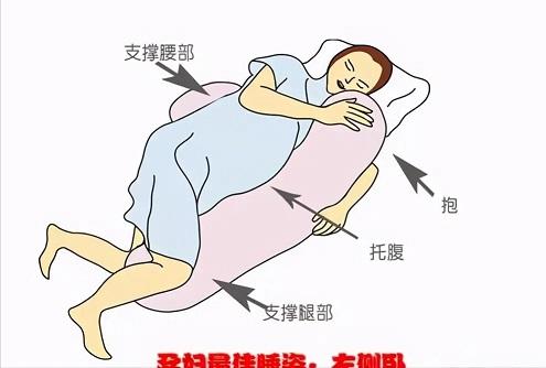 医生建议孕晚期孕妇向左侧睡,可是睡觉中睡姿改变了怎么办?