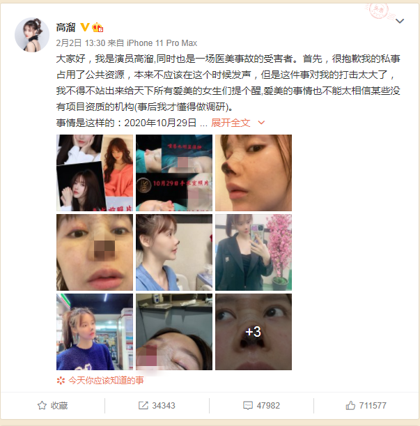 女演员高溜整容失败鼻尖坏死续:已和涉事美容门诊达成和解
