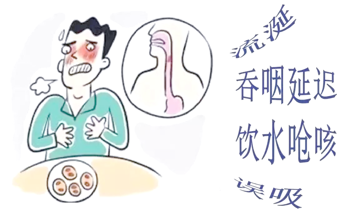 健康科普:全面了解"误吸"风险与预防方法