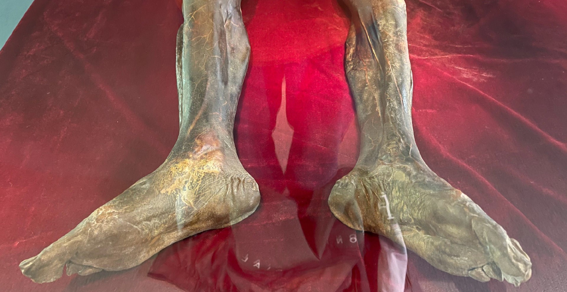 唐朝边防军干尸,皮肤还有弹性,头部多处伤痕,生前经历令人心疼