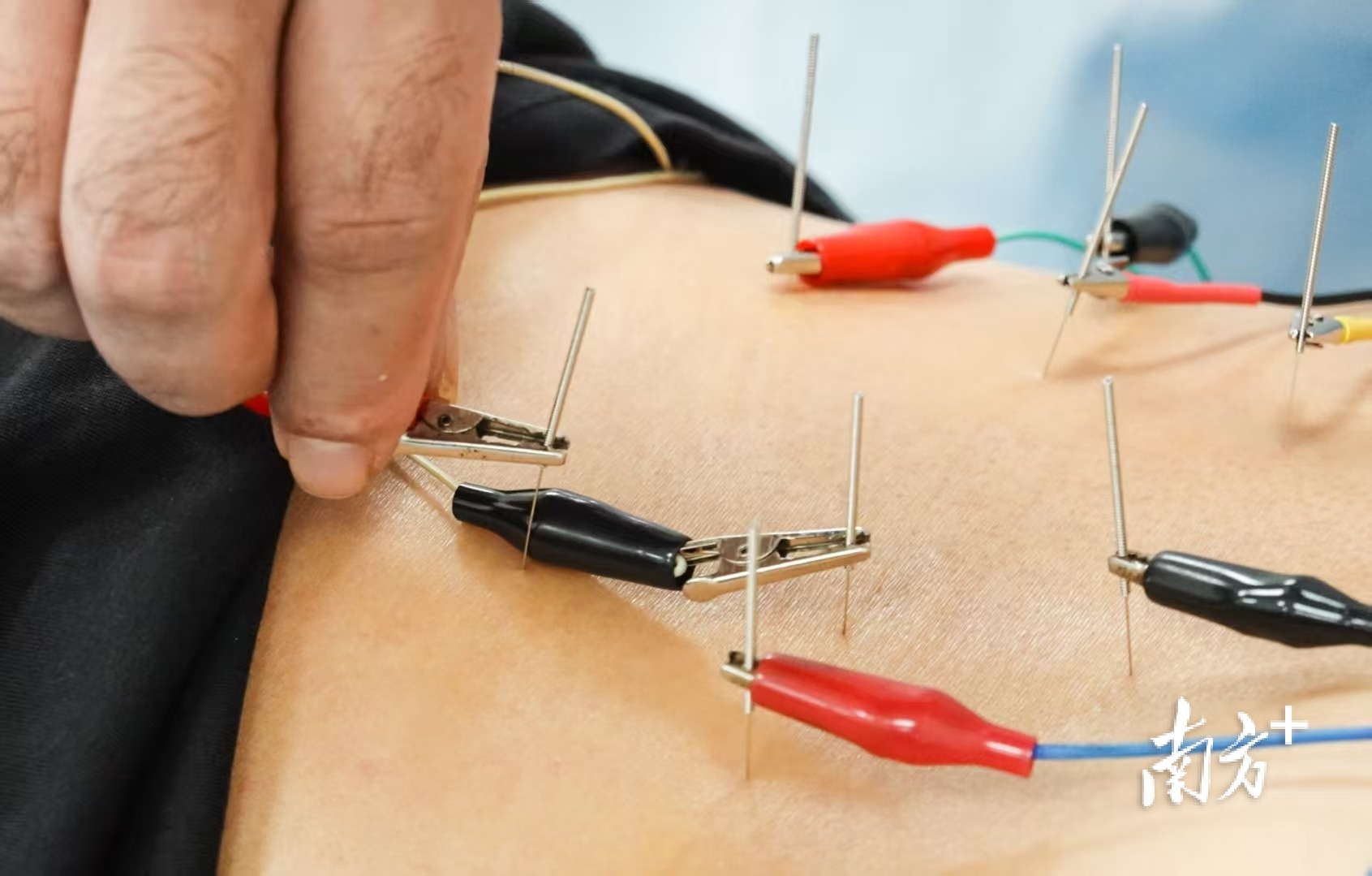 友誼醫(yī)院代掛專家號加代問診康復(fù)訓(xùn)練專業(yè)指導(dǎo)，恢復(fù)效果更佳的簡單介紹