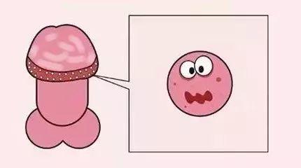 包皮垢的形成和危害 塘沽哪家能解决包皮问题