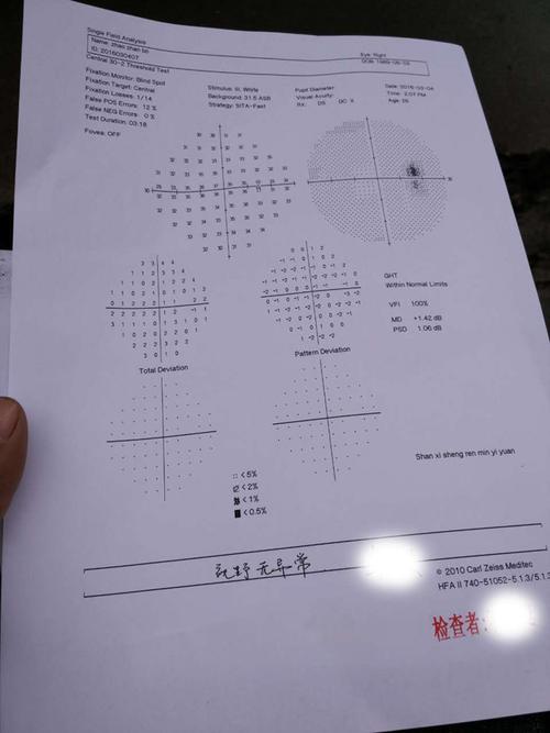单眼驾照水平视野测试有几次机会