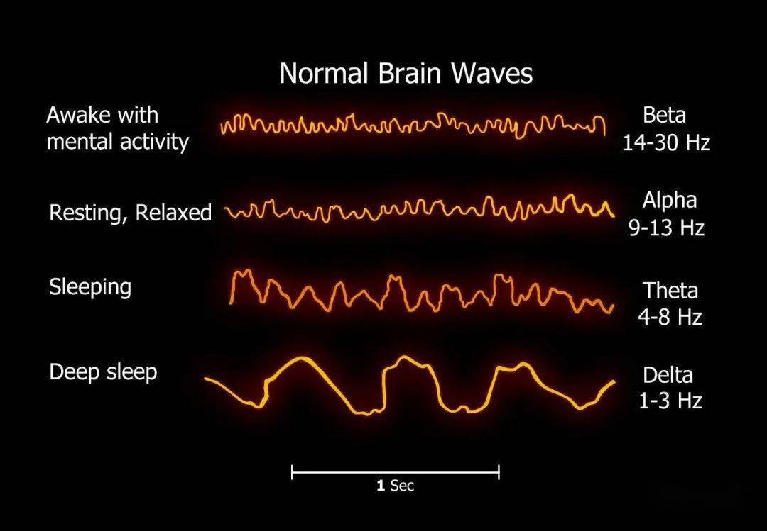 5种不同类型脑波，有着不同的作用你知道吗？