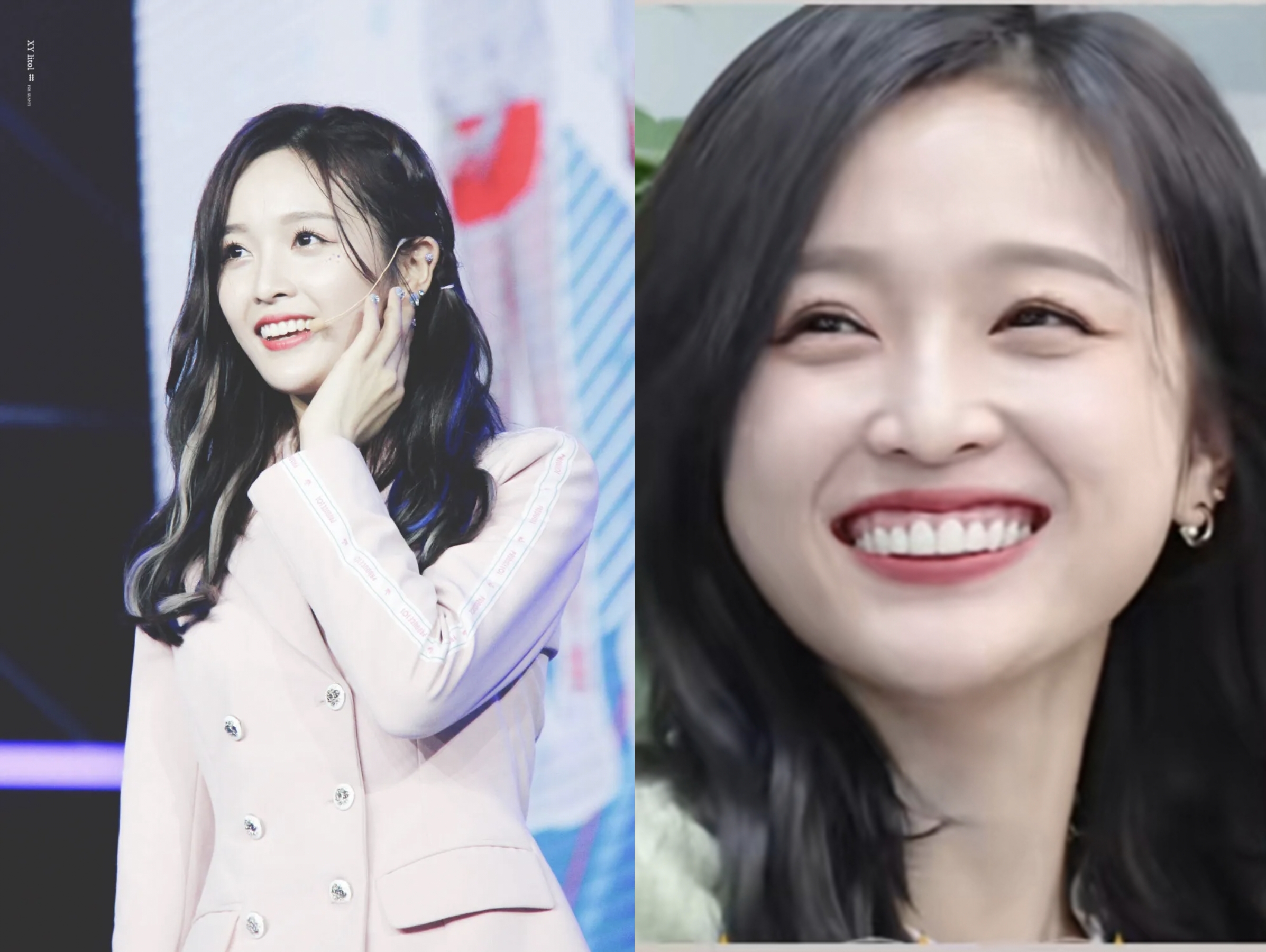 明星竞相整牙,有人变好看,也有人变成了这样?