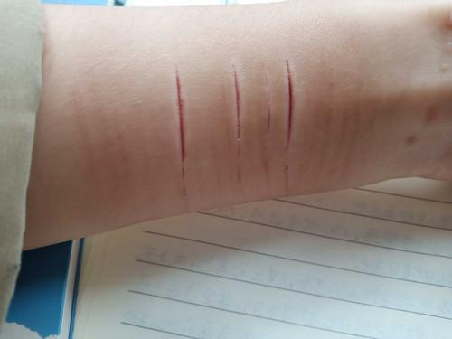 割腕与断臂的致死差异及急救止血技巧解析