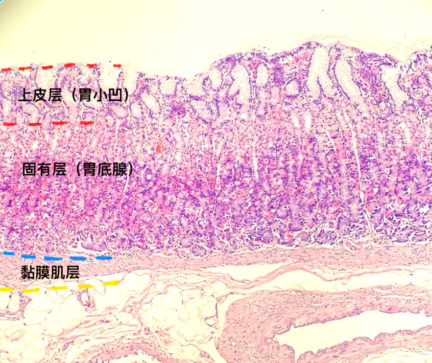 胃壁正常组织学病理基础详解