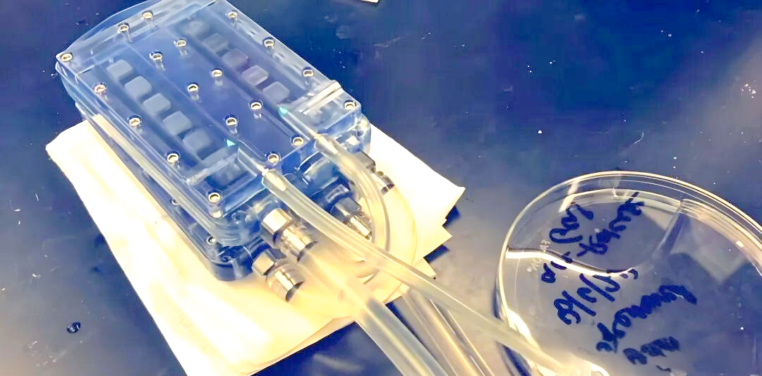植入式人工肾:开启自由生活的未来