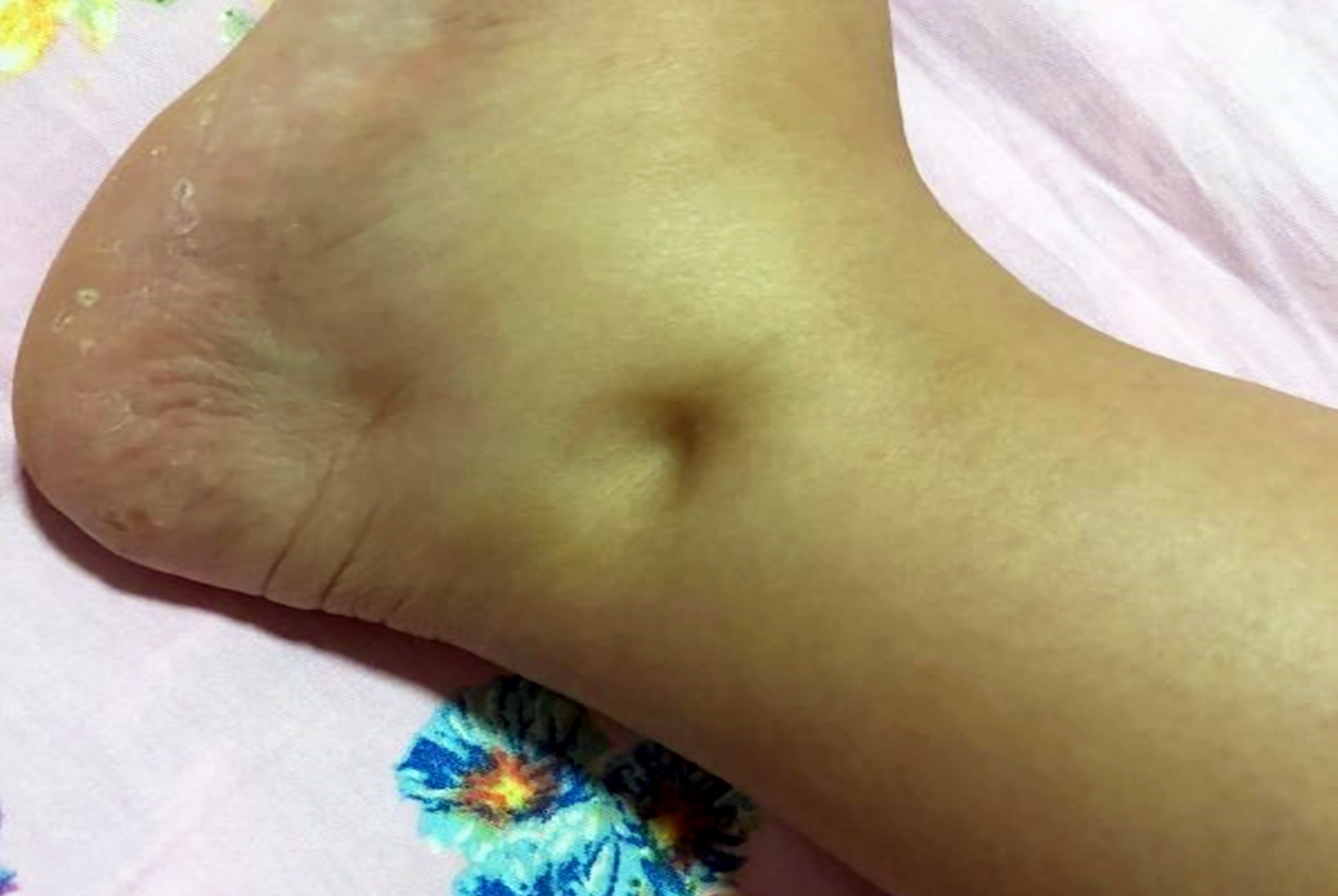 朱丹怀二胎穿拖鞋参加节目,网友批评没教养,孕妈腿肿应该被理解