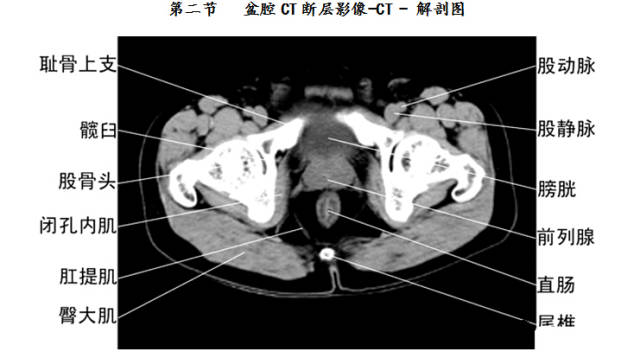 全身ct高清图谱(建议收藏)