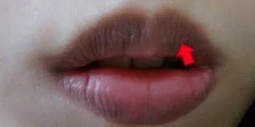 嘴唇暗沉发紫?或是疾病预兆?3分钟教你辨唇色知健康