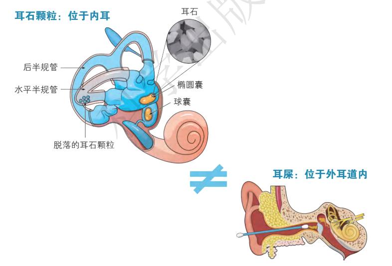 眩晕居家自助专辑系列之三:六问耳石症